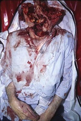 viraldeath_com_shotgun_suicide407.jpg