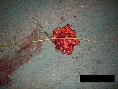corpse3.jpg
