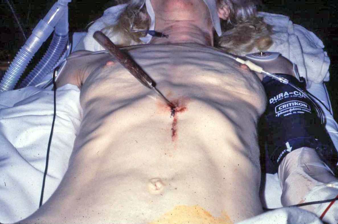 female stab wound.jpg