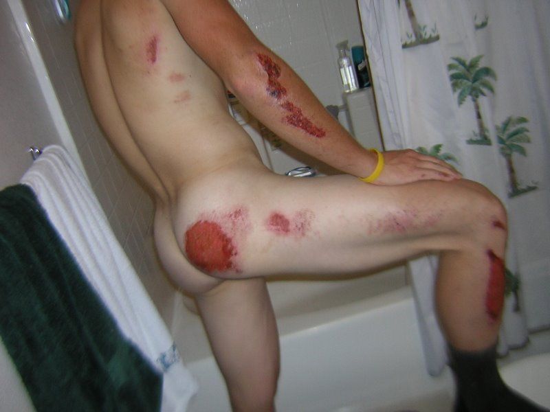 motorcycle-road-rash-pictures- (1).JPG