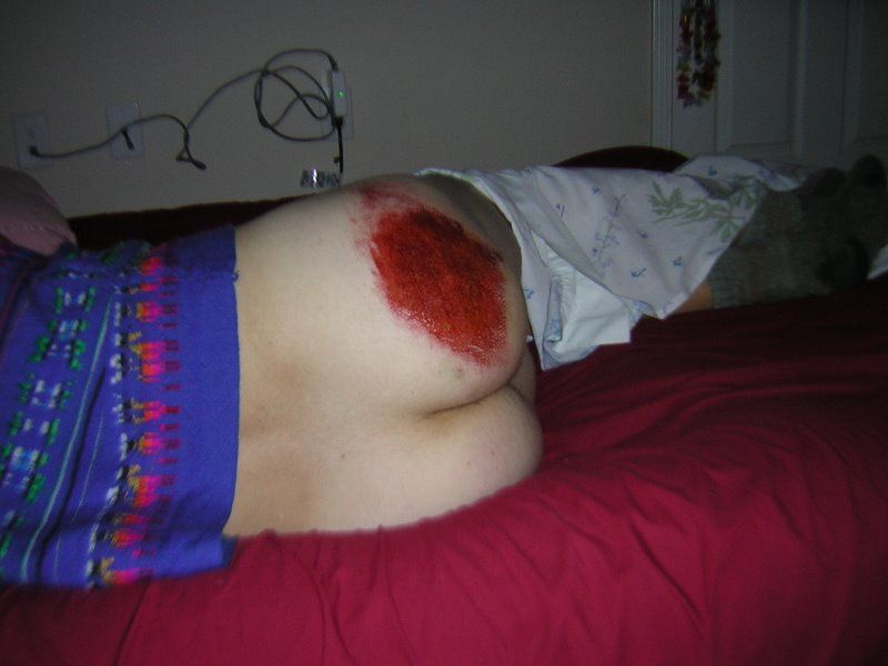 motorcycle-road-rash-pictures-.JPG