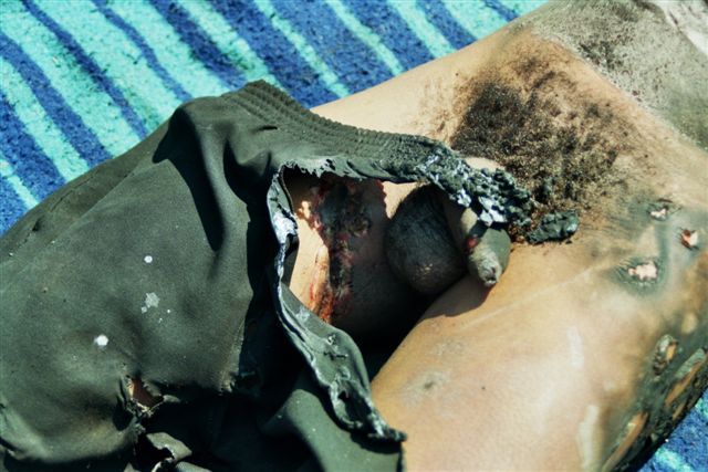 copper thief electrocuted 8.jpg
