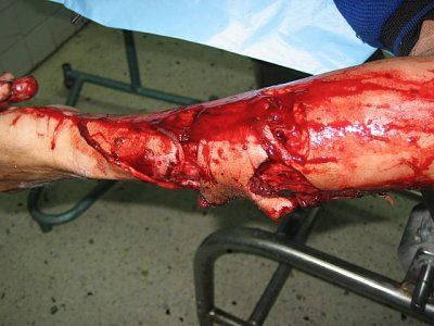 pitbull-bite.jpg