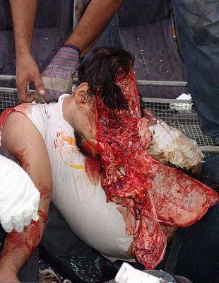 crash-victim.jpg
