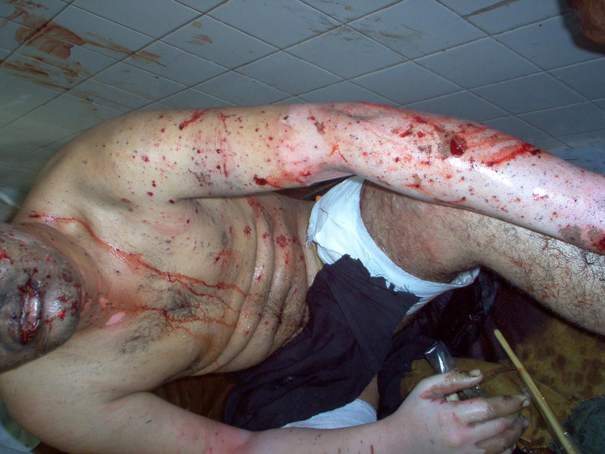 orig_hospital_vbied_012_182.jpg