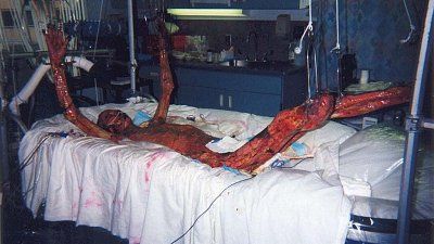 skinned.jpg