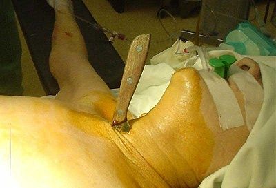 11199510117surgery_pictures.jpg