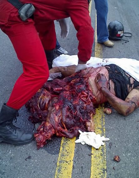 Dead motorcyclist.jpg