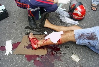 motorcyclist-wound-2.jpg