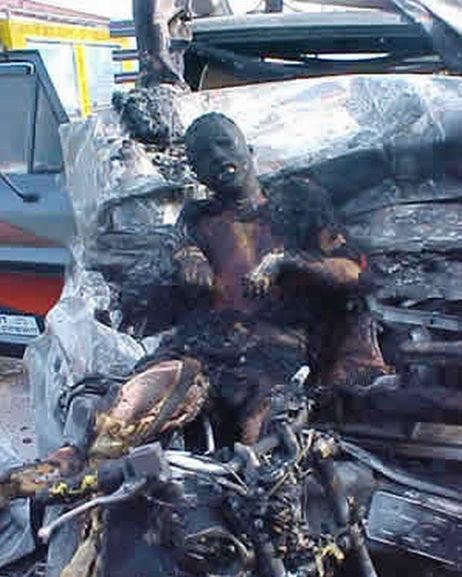 burned motorcyclist vs truck 3.jpg
