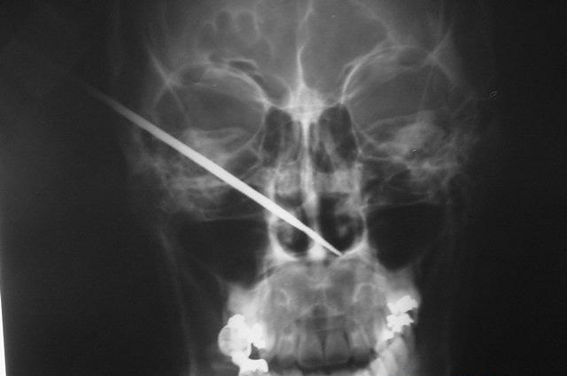 neuro0008d.jpg