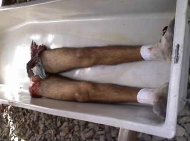 LEGS.jpg