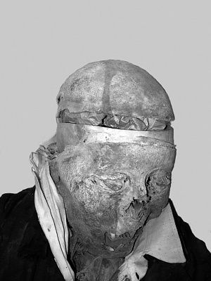 mummy-unidentified-body-craniotomy.jpg