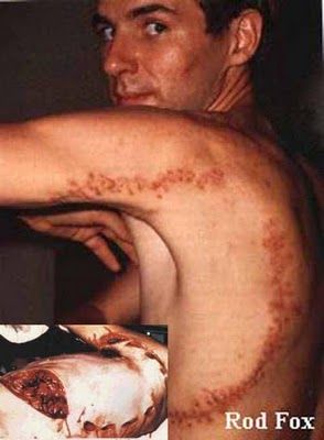 15 of the Weird Shark Attacks Ever 14.jpg
