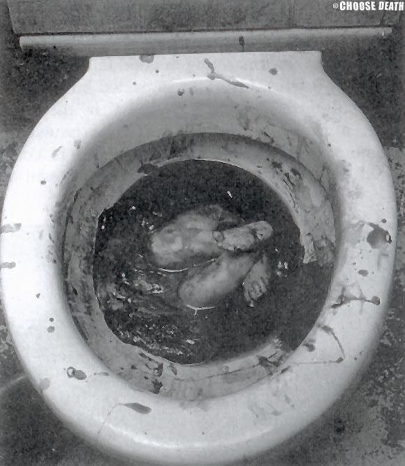 Baby born to teenage girl directly into lavatory pan..jpg