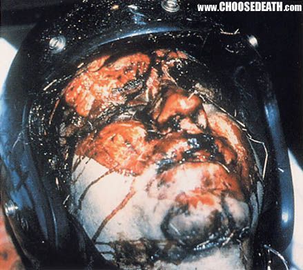 Most motorcyclists die from head trauma even if they are wearing helmets..jpg