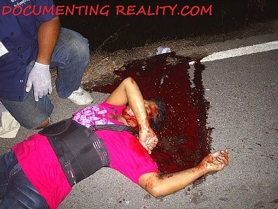 17762-lol-goofy-paramedic-takes-photoshoot-weird-looking-dead-ladybig6.jpg