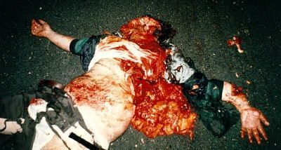 suicide-roadkill.jpg