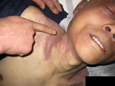 strangled1.jpg