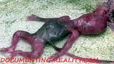 ABORTION INDIA1.jpg