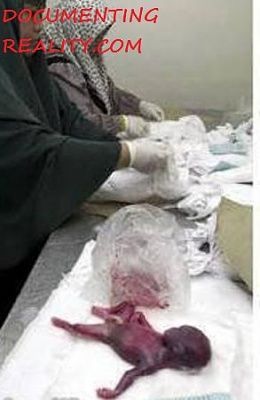 abortion-india2.jpg