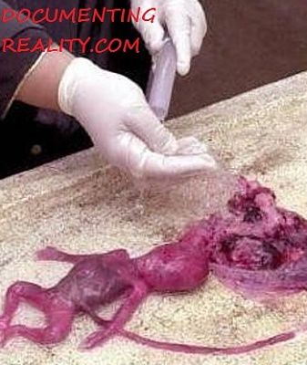 abortion-india3.jpg