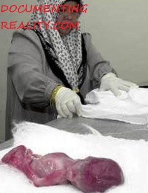 ABORTION INDIA4.jpg