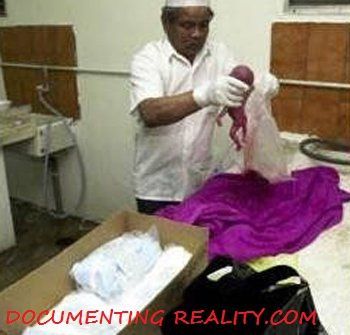 ABORTION INDIA5.jpg