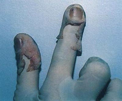 fingerprinting1.jpg