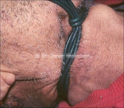strangled2.jpg