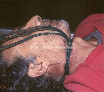 strangled3.jpg