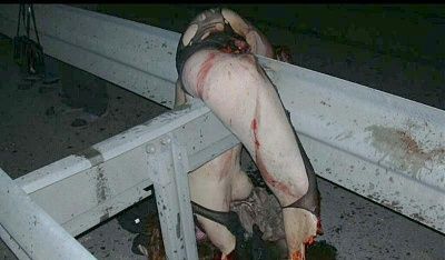 charonboat_dot_com_traumatic_dismemberment_1.jpg