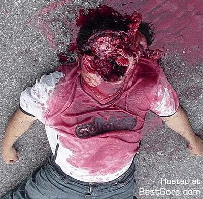 shotgun-wound-face-gruesome-victim-pic.jpg