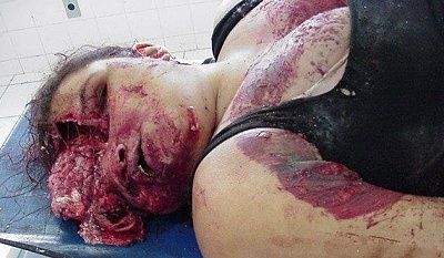 fat-woman-brain-leak-head-blast-02.jpg