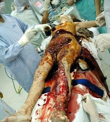 ginsu-knife-attack-victim-01.jpg