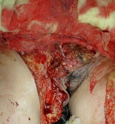 ginsu-knife-attack-victim-03.jpg