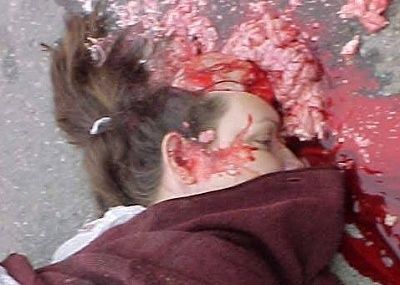 girl-bike-truck-collision-brain-road-01.jpg