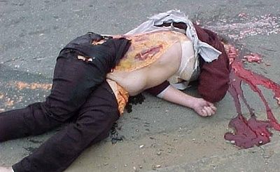 girl-bike-truck-collision-brain-road-05.jpg
