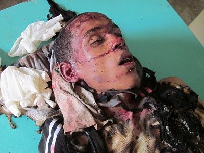 hombre-quemado-yaguate-1.jpg