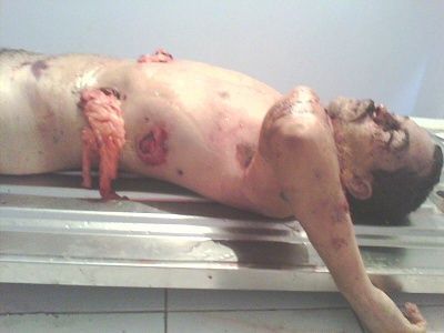 gunshot1.jpg