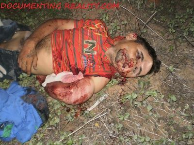 viraldeath_com-head-trauma-2.jpg