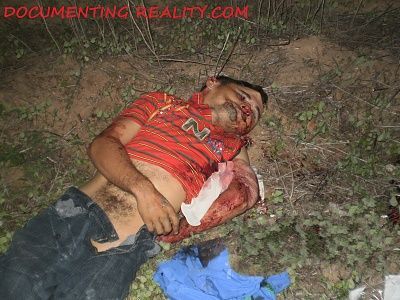 viraldeath_com-head-trauma-3.jpg