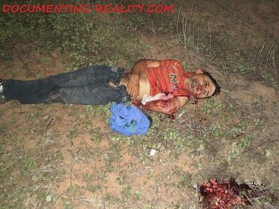 viraldeath_com-head-trauma-5.jpg