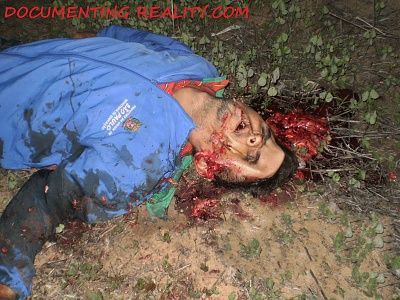 viraldeath_com-head-trauma-10.jpg