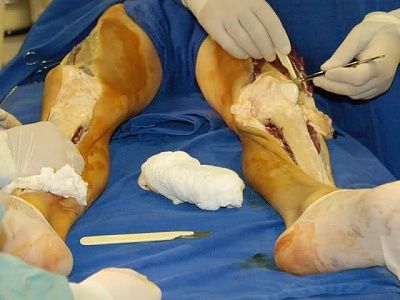 leg02.jpg