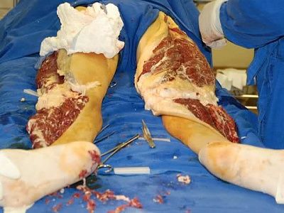 leg03.jpg