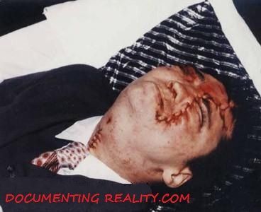 funeralshotselfinhead2.jpg