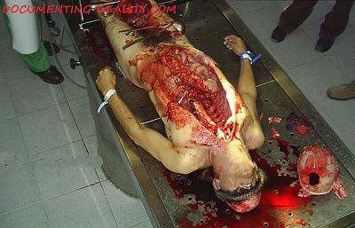 autopsy.jpg
