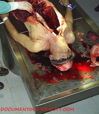 autopsy1.jpg