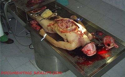 autopsy2.jpg